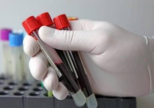 取卵后腹水多久能消失？用这些方法能够加快腹水的消失