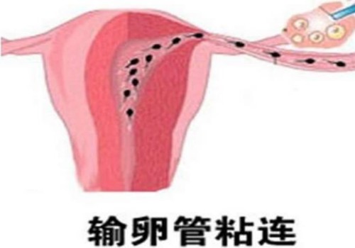 杭州试管供卵代怀：﻿滋肾育胎丸有必要吃吗,早期吃滋肾育胎丸有坏处吗
