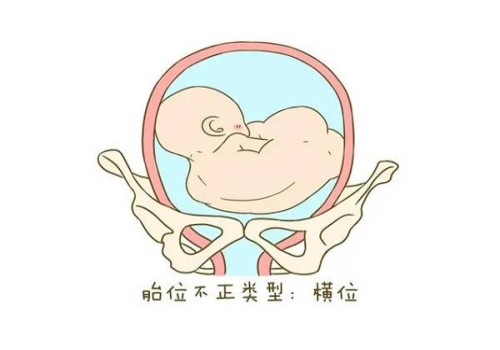 杭州试管供卵：﻿Y染色体的作用你都了解吗？
